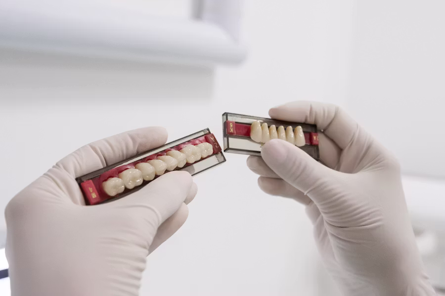 Cura dell'impianto dentale — Studio Dentistico Maggiori