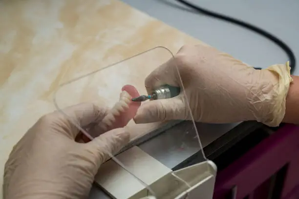 Implantologia — Studio Dentistico Maggiori