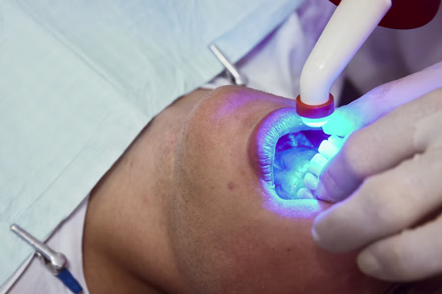 Sbiancamento denti professionale in studio — Studio Dentistico Maggiori