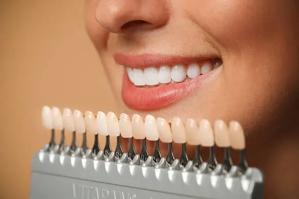 Sorriso perfetto con trattamenti di estetica dentale — Studio Dentistico Maggiori